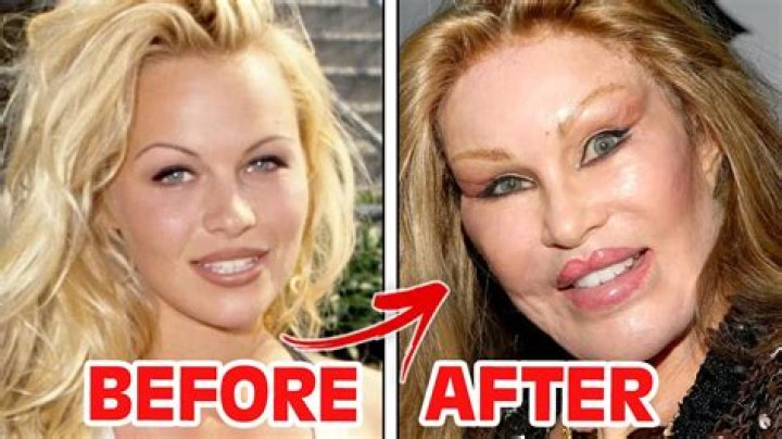 Kim Basinger Plastic Surgery Before And After | What Wrong With Her Face
